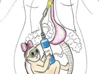 Киселини по време на бременност – как да се справим с&nbsp;тях